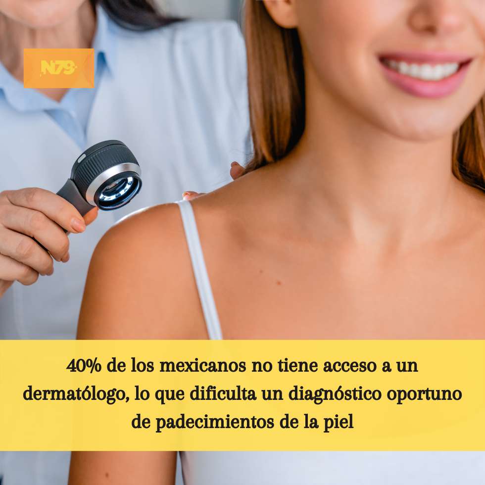 40% de los mexicanos no tiene acceso a un dermatólogo, lo que dificulta un diagnóstico oportuno de padecimientos de la piel
