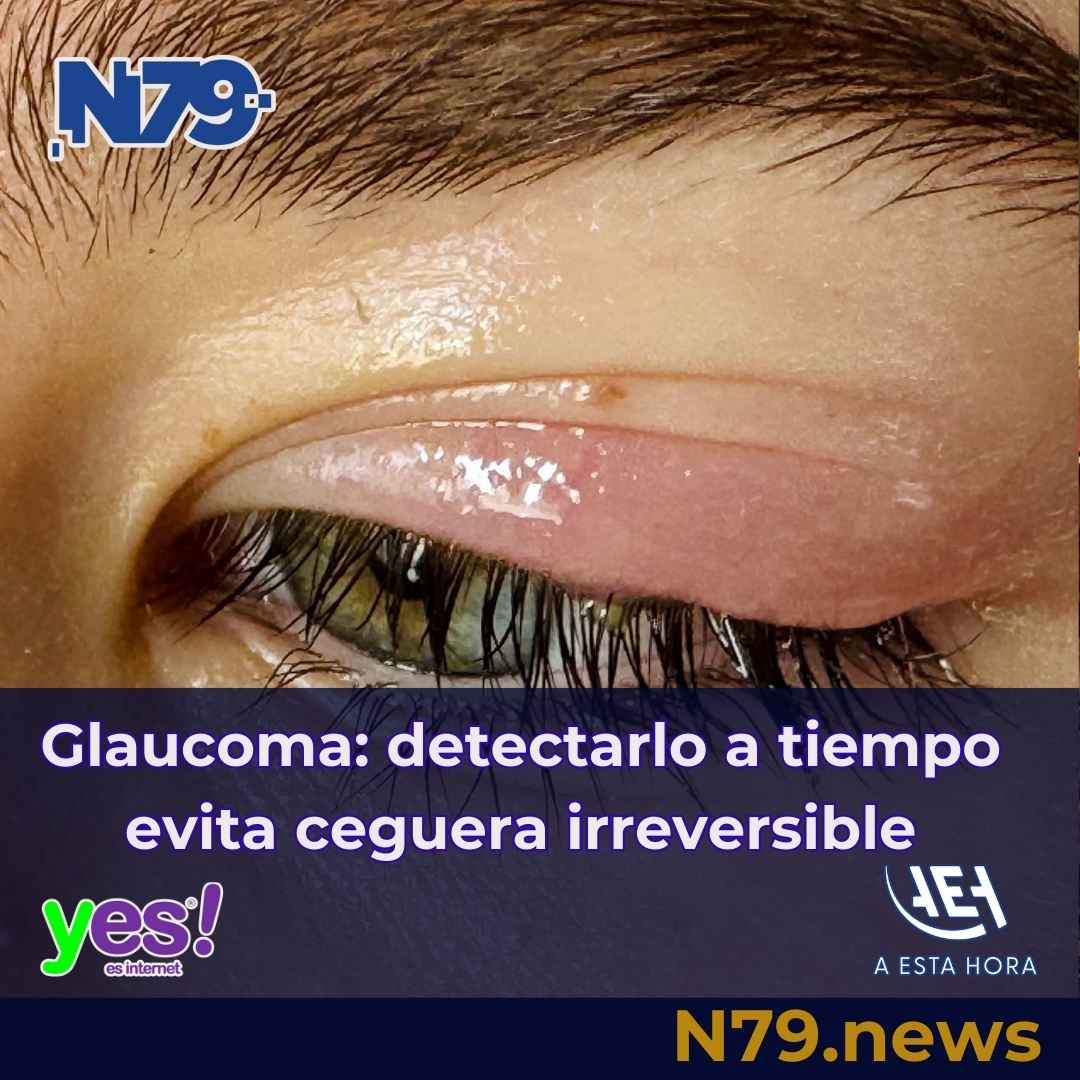 Glaucoma detectarlo a tiempo evita ceguera irreversible