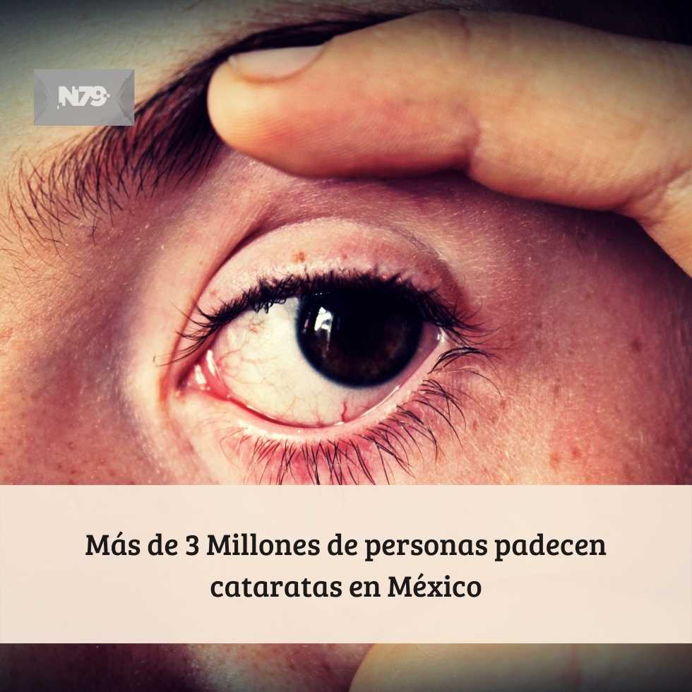 Más de 3 Millones de personas padecen cataratas en México
