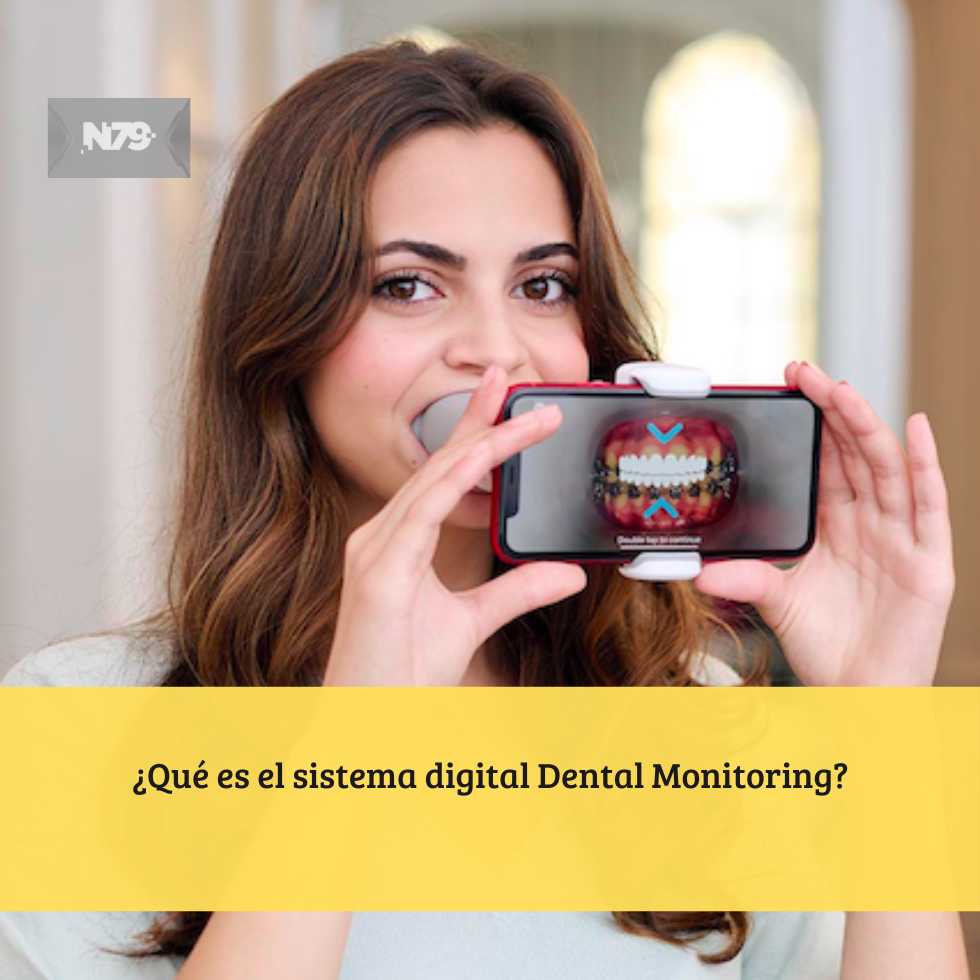 ¿Qué es el sistema digital Dental Monitoring?